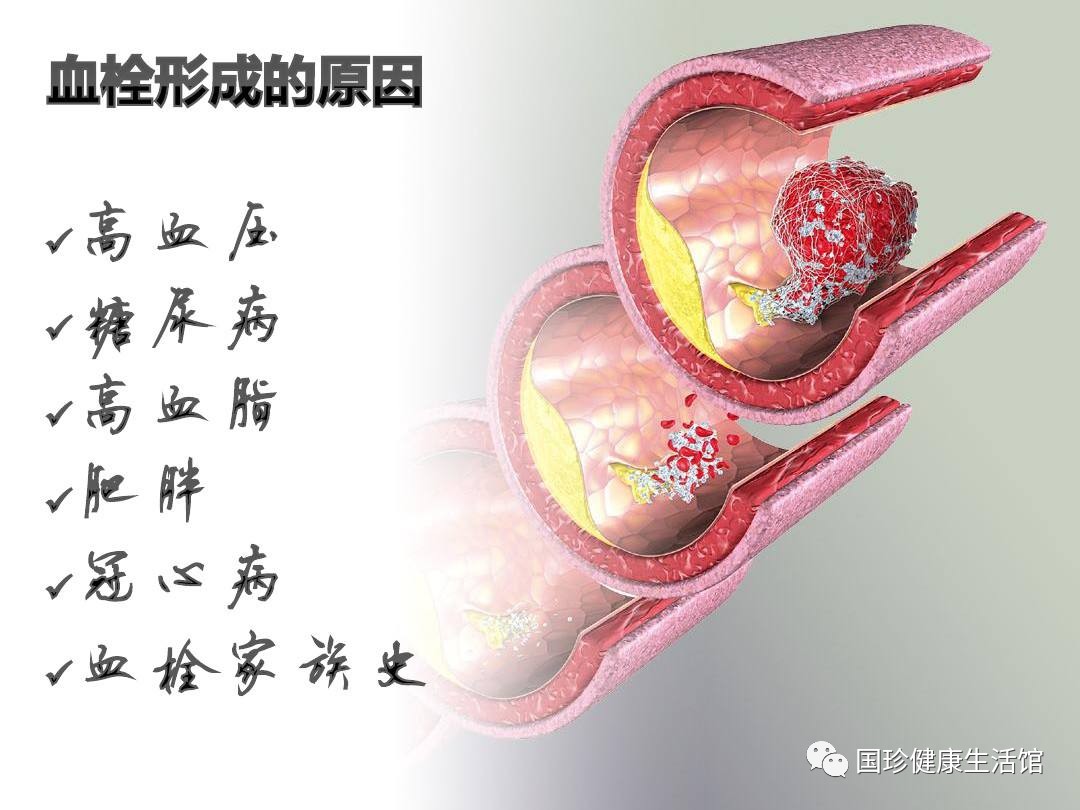 吊顶龙骨材料 第1180页