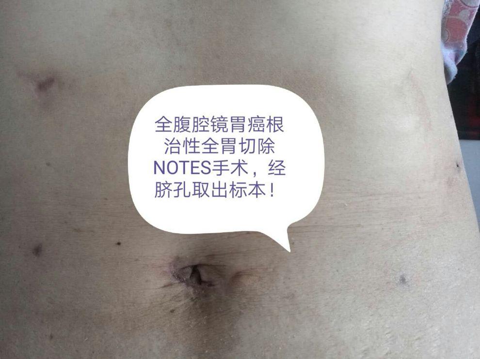 疤痕最新研究进展与应用发展动态